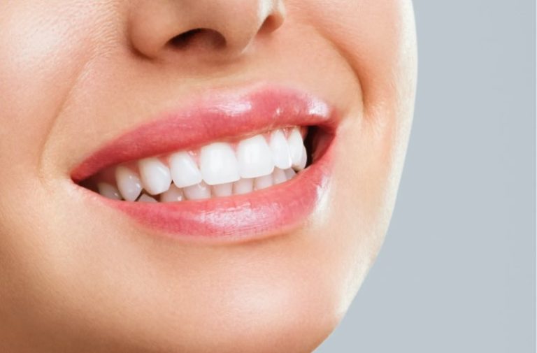 Top 5 Tips For Healthy Teeth